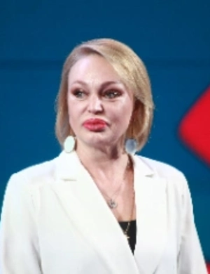 Алла Довлатова разоблачила сомнительную бьюти-процедуру: «У меня вообще никаких изменений не было!»