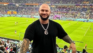 Джиган с подбитым глазом шокировал поклонников