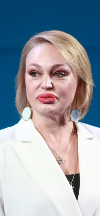 Алла Довлатова разоблачила сомнительную бьюти-процедуру: «У меня вообще никаких изменений не было!»